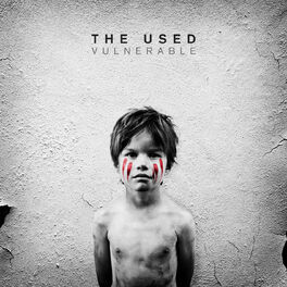 Album cover of Vulnerable
