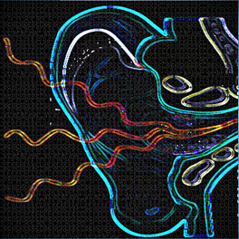 Album cover of Tinnitus (The Ringing in My Ears)