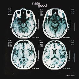 Album cover of X-Ray