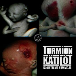 Album cover of Kuolettavia Vammoja