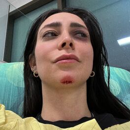 Album cover of faceplant