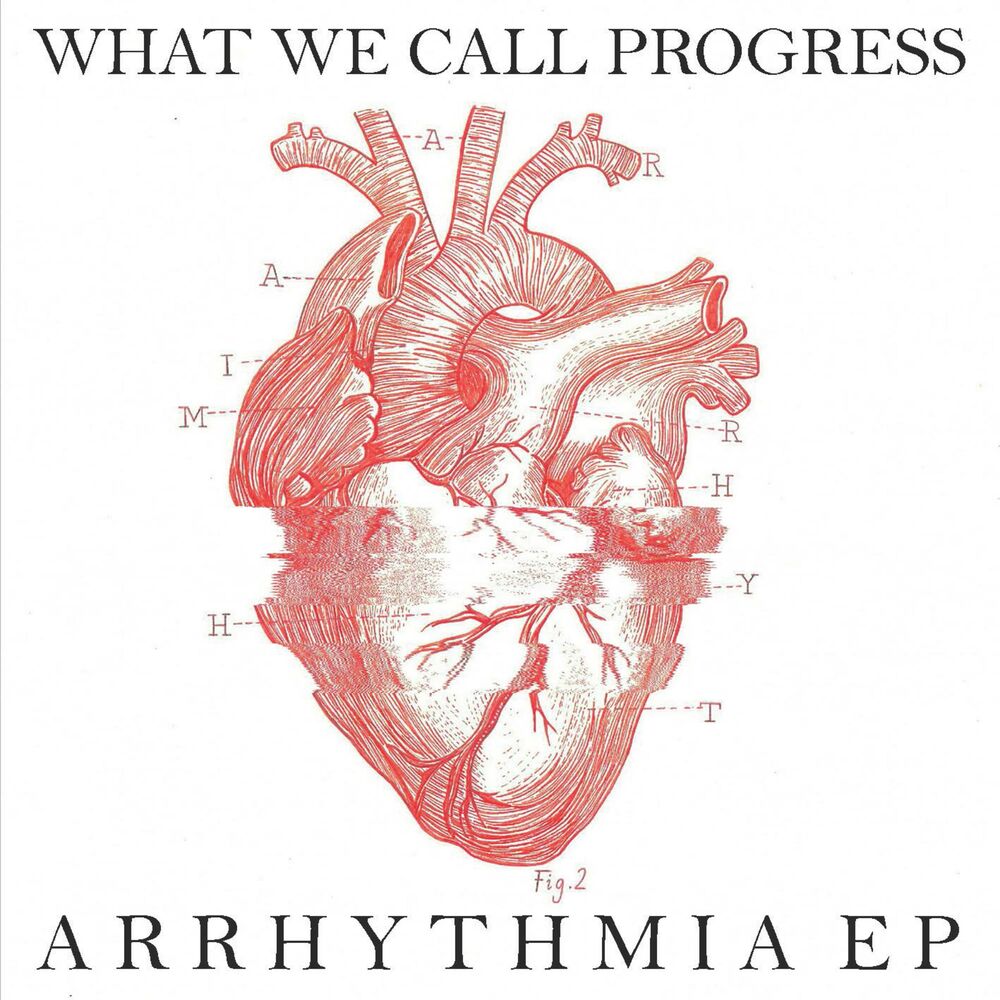 Call progress. Project arrhythmia.