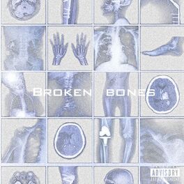 Album cover of Broken Bones