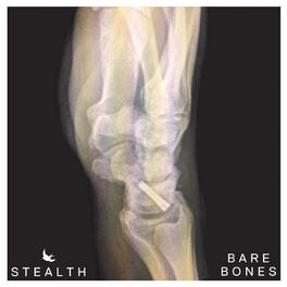 Album cover of Bare Bones