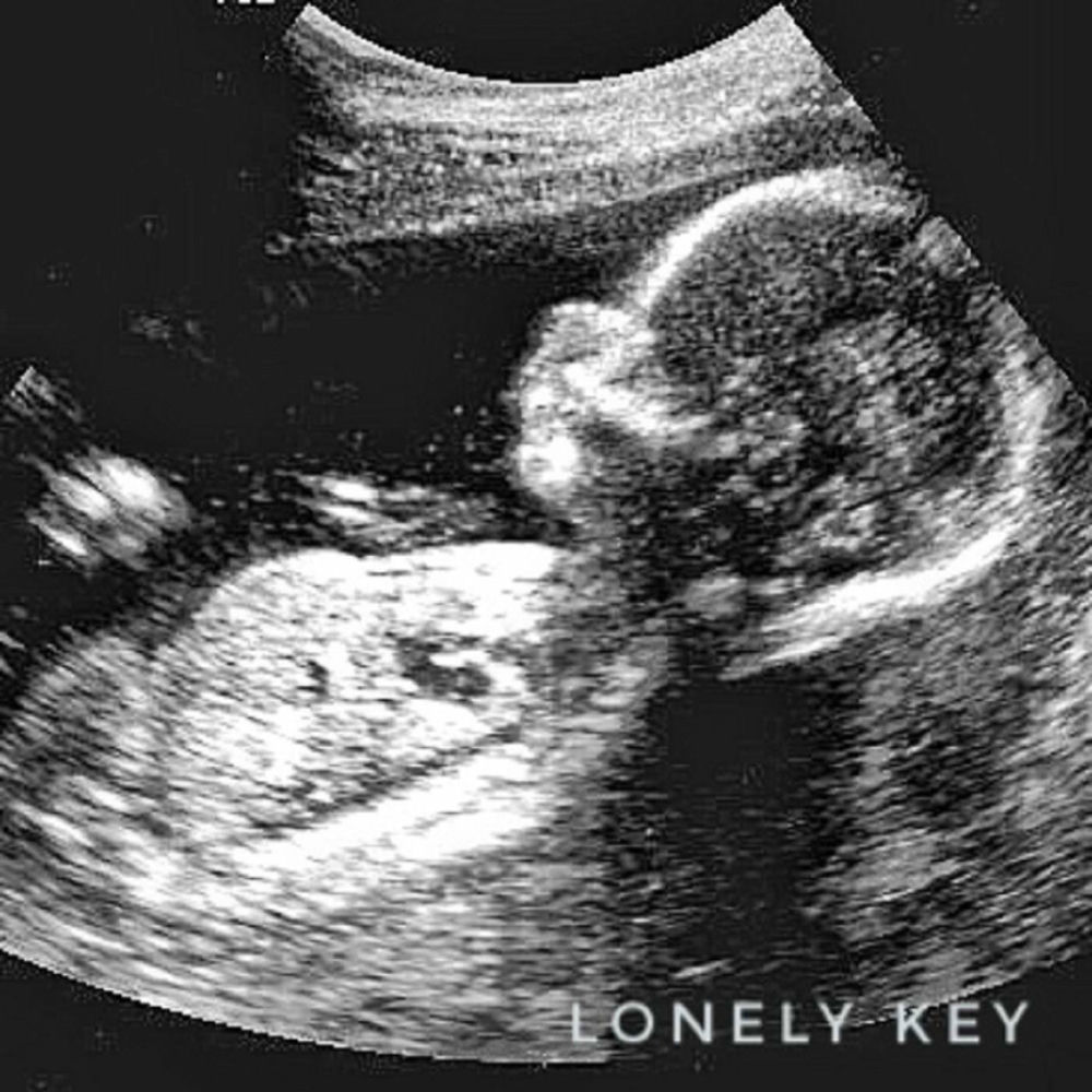 Lonely key. Piano cover metallica. Четыре фортепиано. Lonely key. Lonely key.