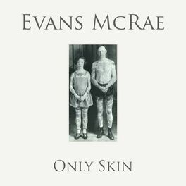 Album cover of Only Skin